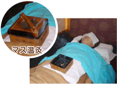 マス鍼灸